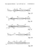 SYSTEMS AND METHODS FOR VASCULAR FILTER RETRIEVAL diagram and image