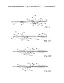 SYSTEMS AND METHODS FOR VASCULAR FILTER RETRIEVAL diagram and image