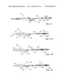 SYSTEMS AND METHODS FOR VASCULAR FILTER RETRIEVAL diagram and image