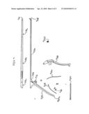 SPINAL BUTTRESS PLATE diagram and image