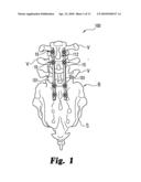 Dynamic Anchor Assembly for Connecting Elements in Spinal Surgical Procedures diagram and image