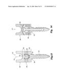 Dynamic Anchor Assembly for Connecting Elements in Spinal Surgical Procedures diagram and image