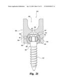 Dynamic Anchor Assembly for Connecting Elements in Spinal Surgical Procedures diagram and image