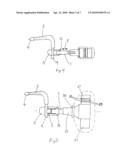 REMOVAL OF PROSTHESES diagram and image