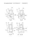 REMOVAL OF PROSTHESES diagram and image