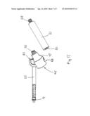 REMOVAL OF PROSTHESES diagram and image