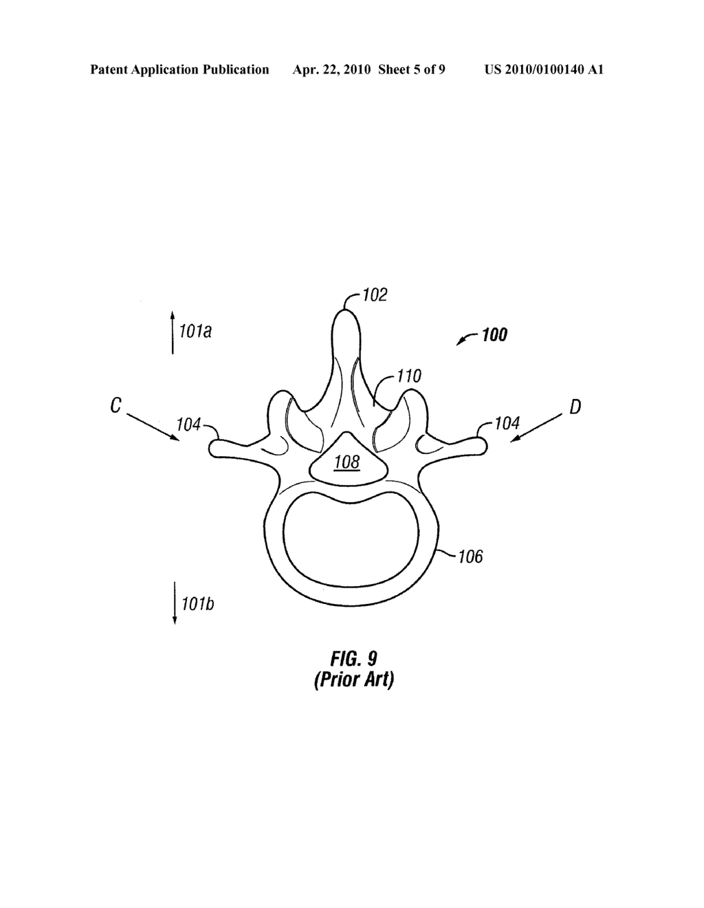 INSERTION TOOL FOR A VERTEBRAL DEFECT DEVICE - diagram, schematic, and image 06