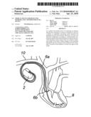 MEDICAL DEVICE FOR DETECTING ISCHEMIA AND A METHOD FOR SUCH A DEVICE diagram and image