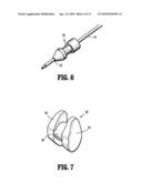 SWELLABLE INTERSPINOUS STABILIZATION IMPLANT diagram and image