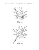 METHOD AND STRUCTURE FOR STABILIZING A VERTEBRAL BODY diagram and image