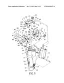 Trouble-free safety prosthesis joint diagram and image