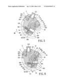 Trouble-free safety prosthesis joint diagram and image