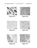 Models of Malignant Brain Cancer, and Therapeutic siRNAs Against Oncogenic Signaling Pathways, and Methods and Kits for Uses Therefor diagram and image