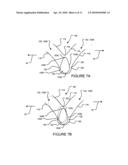 APPARATUS FOR MITIGATING SPINAL CORD INJURY diagram and image