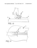 TREMOLO ATTACHMENT FOR A STRINGED INSTRUMENT diagram and image