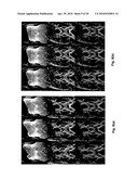 DYNAMIC COMPOSITE GRADIENT SYSTEMS FOR MRI diagram and image