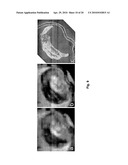 DYNAMIC COMPOSITE GRADIENT SYSTEMS FOR MRI diagram and image