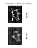 DYNAMIC COMPOSITE GRADIENT SYSTEMS FOR MRI diagram and image