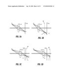 AUTO-FOCUS TECHNIQUE IN AN IMAGE CAPTURE DEVICE diagram and image