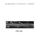 METHOD FOR ANALYZING MUCOSA SAMPLES WITH OPTICAL COHERENCE TOMOGRAPHY diagram and image