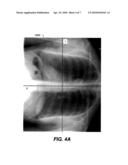 ORIENTATION DETECTION FOR CHEST RADIOGRAPHIC IMAGES diagram and image