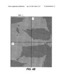 ORIENTATION DETECTION FOR CHEST RADIOGRAPHIC IMAGES diagram and image