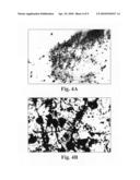 Methods of treating Parkinson s disease using viral vectors diagram and image