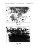 Methods of treating Parkinson s disease using viral vectors diagram and image