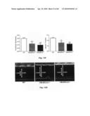 Method for Preventing and Treating Cardiovascular Diseases with BRCA1 diagram and image