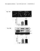 Method for Preventing and Treating Cardiovascular Diseases with BRCA1 diagram and image