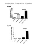 Method for Preventing and Treating Cardiovascular Diseases with BRCA1 diagram and image