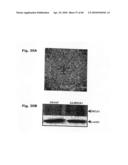 Method for Preventing and Treating Cardiovascular Diseases with BRCA1 diagram and image