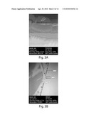 CELL TRANSPLANTATION diagram and image