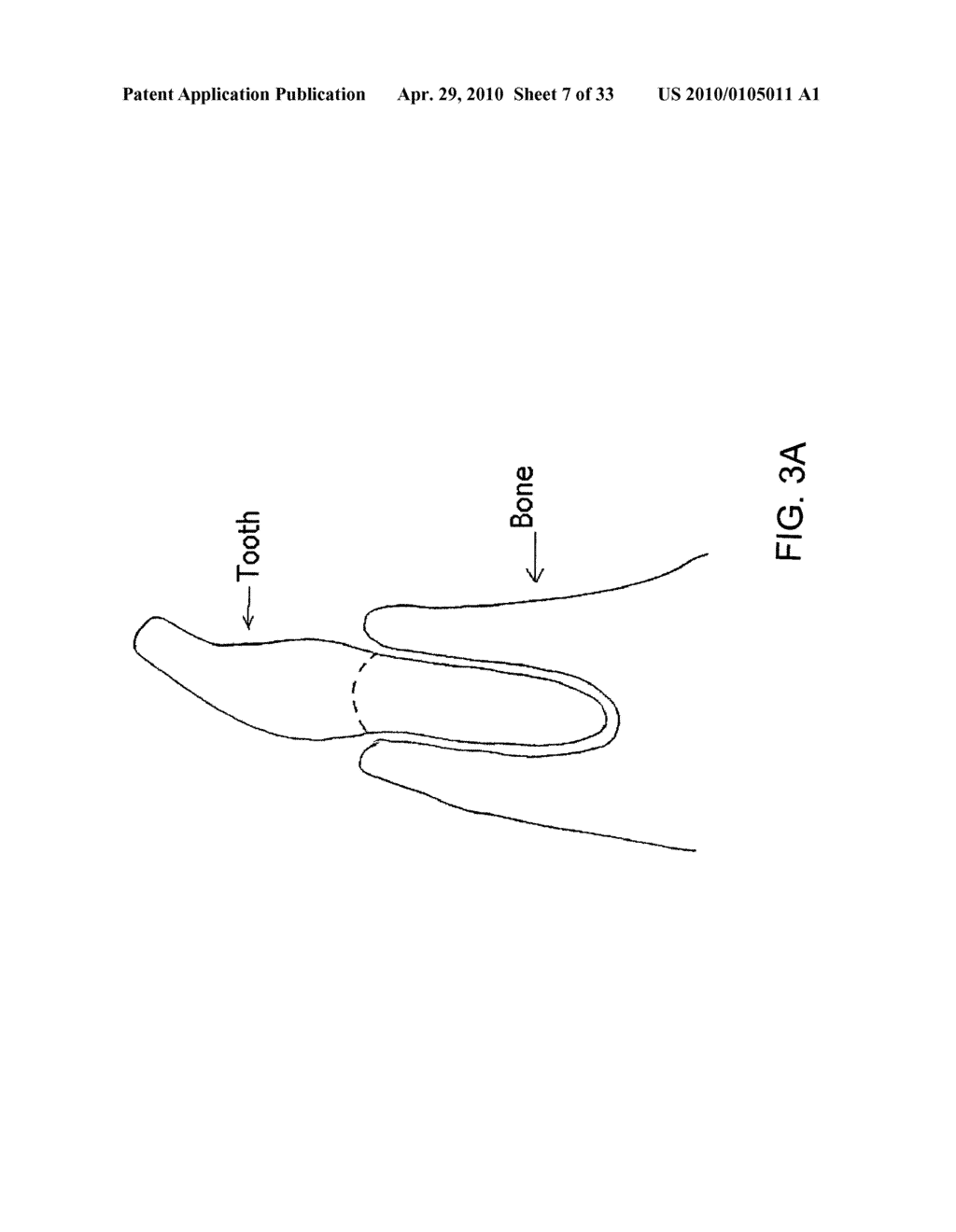 System, Method And Apparatus For Tooth Implant Planning And Tooth Implant Kits - diagram, schematic, and image 08