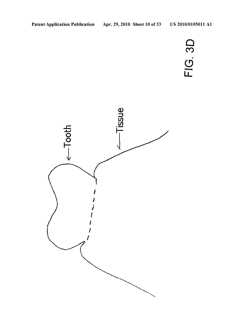 System, Method And Apparatus For Tooth Implant Planning And Tooth Implant Kits - diagram, schematic, and image 11