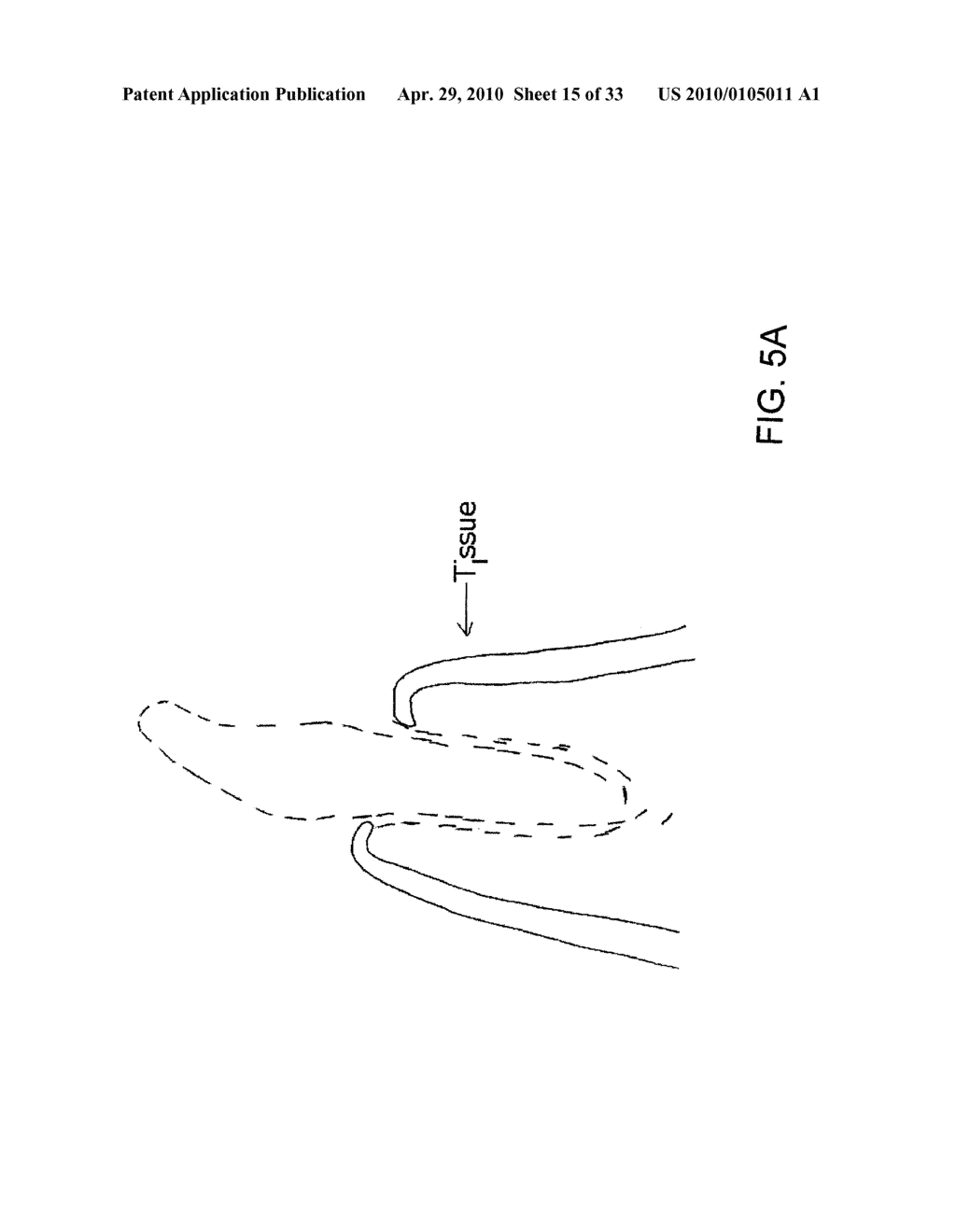 System, Method And Apparatus For Tooth Implant Planning And Tooth Implant Kits - diagram, schematic, and image 16