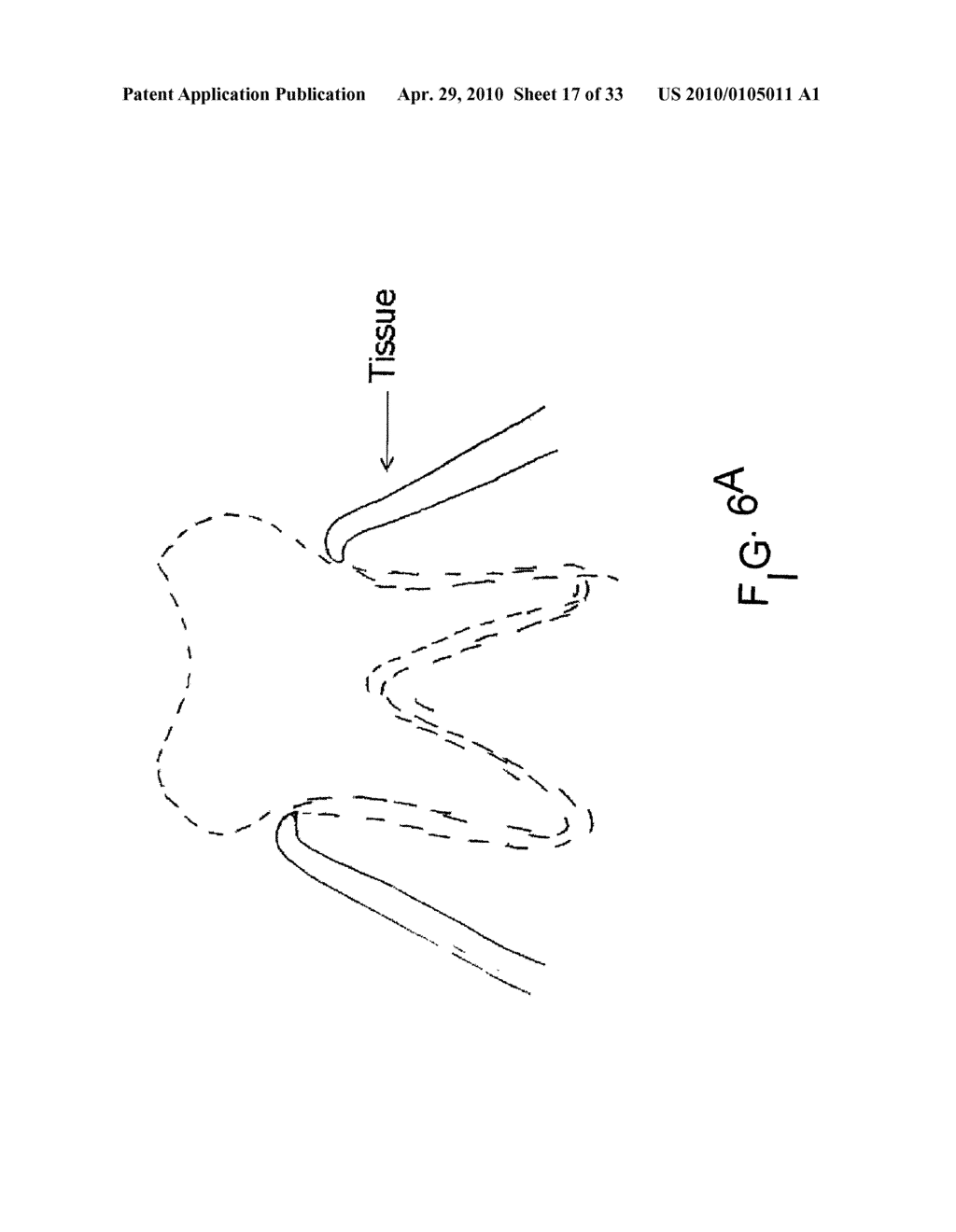 System, Method And Apparatus For Tooth Implant Planning And Tooth Implant Kits - diagram, schematic, and image 18