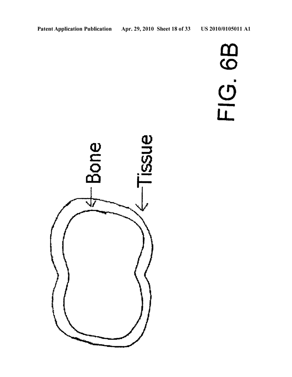 System, Method And Apparatus For Tooth Implant Planning And Tooth Implant Kits - diagram, schematic, and image 19