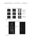 Sulfonylurea-Responsive Repressor Proteins diagram and image