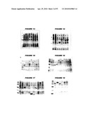 Nucleic acids and proteins from streptococcus groups a & b diagram and image