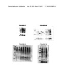 Nucleic acids and proteins from streptococcus groups a & b diagram and image