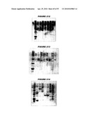 Nucleic acids and proteins from streptococcus groups a & b diagram and image