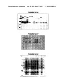 Nucleic acids and proteins from streptococcus groups a & b diagram and image