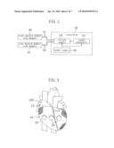 HEART ASSIST DEVICE diagram and image