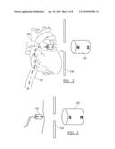 System and Method for Guiding a Medical Instrument with Magnetic Force Control diagram and image