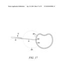 Surgical Access System and Related Methods diagram and image