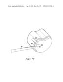 Surgical Access System and Related Methods diagram and image