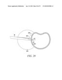 Surgical Access System and Related Methods diagram and image