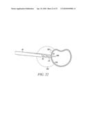 Surgical Access System and Related Methods diagram and image