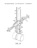 Surgical Access System and Related Methods diagram and image